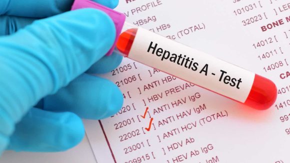 Oms Monitora 169 Casos De Hepatite Aguda Desconhecida Há Relato De Uma Morte IpiaÚ On Line 1568